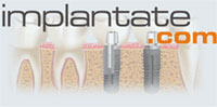 Fachseite für dentale Implantologie und Parodontologie in Deutschland